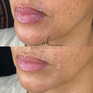 mind body and soul medical chin and lips