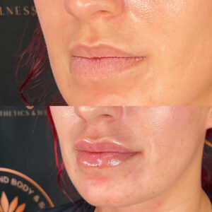 mind body and soul medical clear skin and lips