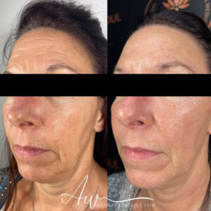 mind body and soul medical face rejuvenation