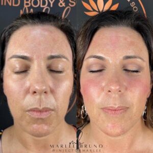 mind body and soul medical facial