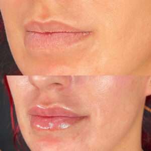 mind body and soul medical facial before and after