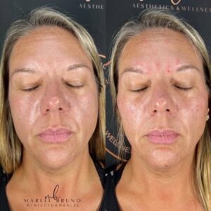 mind body and soul medical facial procedure