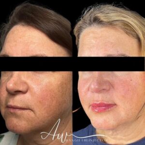 mind body and soul medical forehead