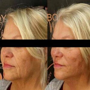 mind body and soul medical full face before and after