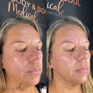 mind body and soul medical full facial shot