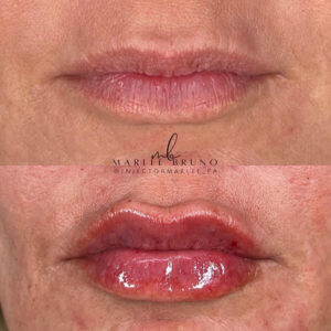 mind body and soul medical fuller lips