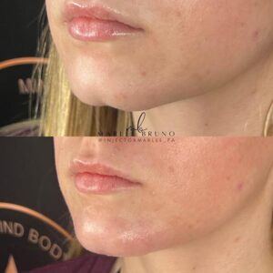 mind body and soul medical left side facial