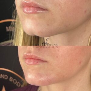 mind body and soul medical left side facial comparison