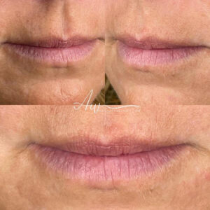 mind body and soul medical lips