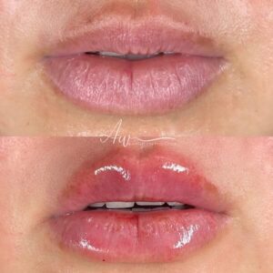 mind body and soul medical lips close-up