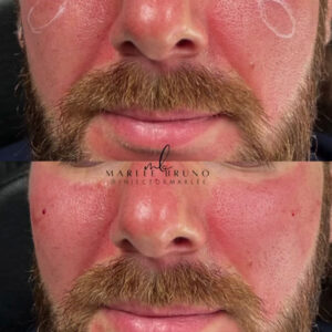 mind body and soul medical mens facial