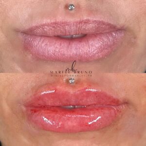 mind body and soul medical pink lips