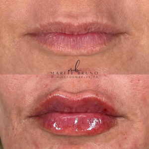 mind body and soul medical red lips