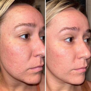 mind body and soul medical right-side facials