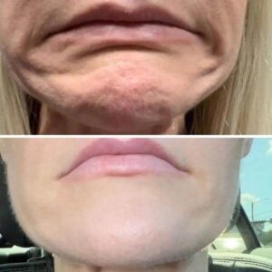 mind body and soul medical smooth chin