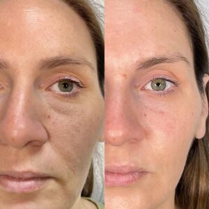 mind body and soul medical smoother skin