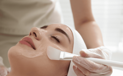 How to Nurture Your Skin After a Chemical Peel