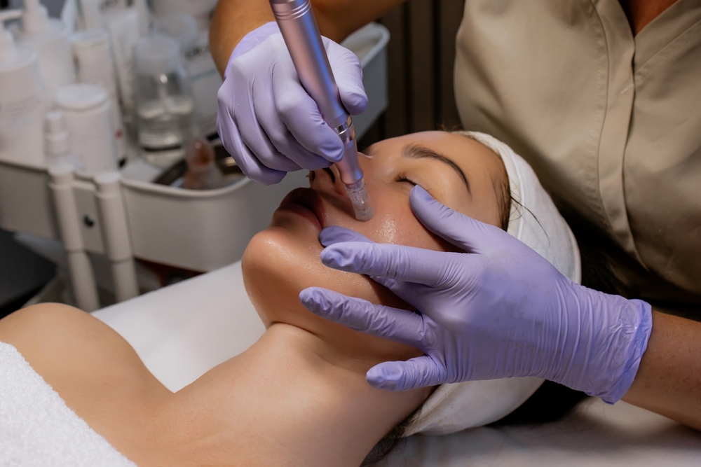 Microneedling Appointments in Pensacola, Florida: What to Expect