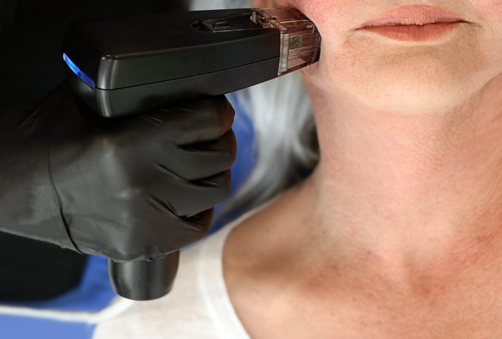 RF Microneedling for Face: A Comprehensive Guide to Morpheus8 in Pensacola