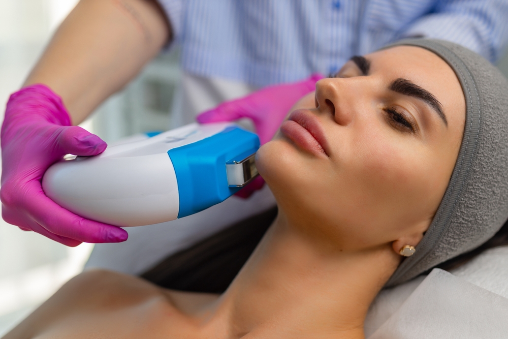 A Detailed Guide to IPL Photofacial in Ferry Pass, FL