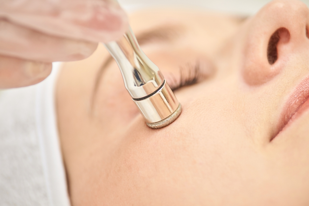 Your Complete Guide to Microdermabrasion in Mobile, Alabama