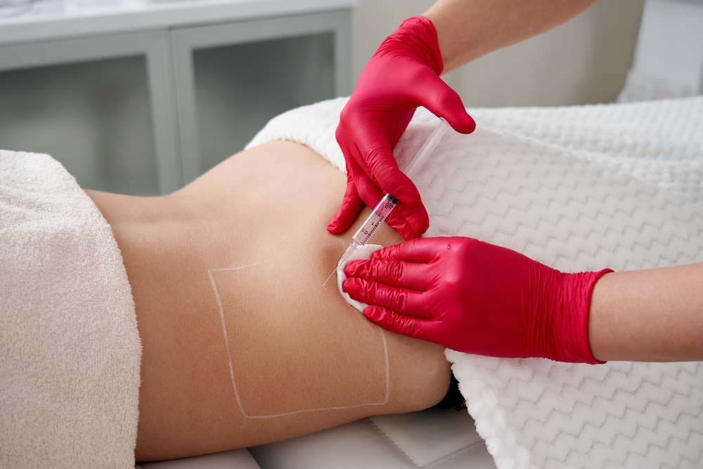 woman receiving lipo injections in Pensacola