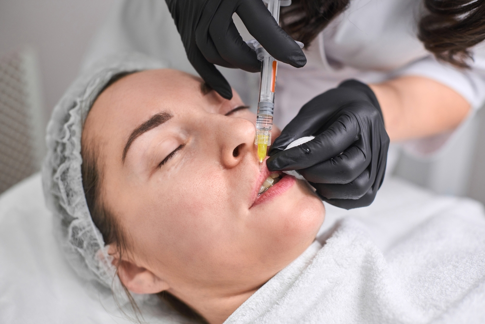 Lip Filler for Thin Lips in Pensacola, FL: The Ultimate Guide