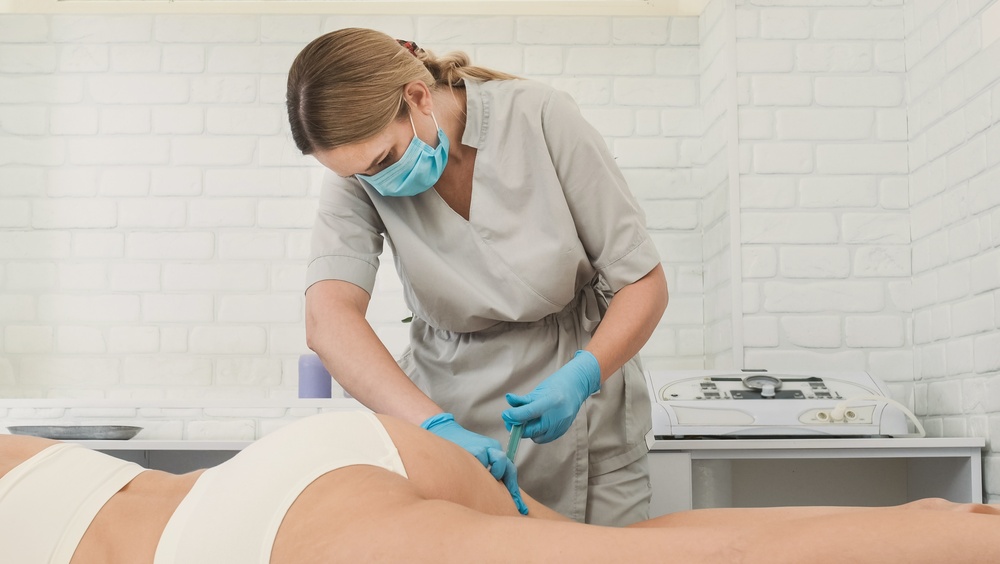4 Benefits of a Non-Surgical Butt Lift With Fillers in Pensacola, FL