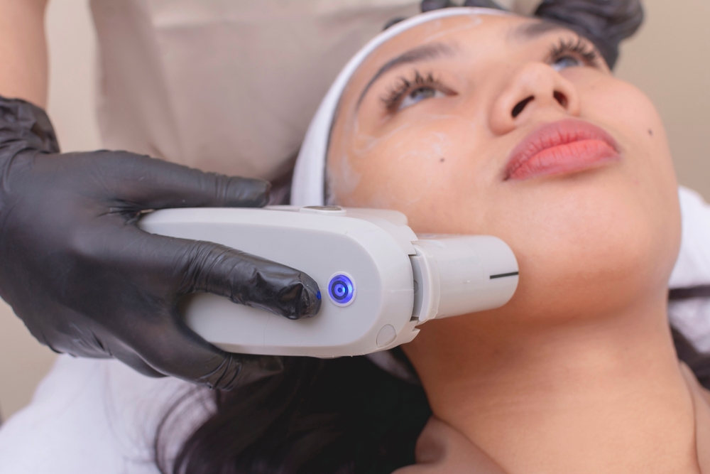 Who is a Good Candidate for Nonsurgical Skin Tightening Near Mobile, AL?