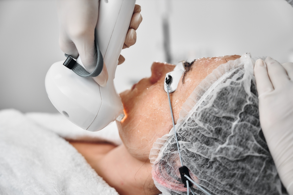 How Many Sessions of IPL Do You Actually Need to See Results?